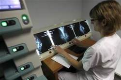 Radiologists not at higher risk of radiation-related mortality