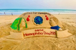 World Hemophilia Day: More than 1.36 lakh people in India suffer from it; what is this rare disease