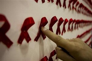 HIV positive adults have poorer hearing: Study