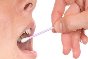 Saliva test may catch deadly diseases early