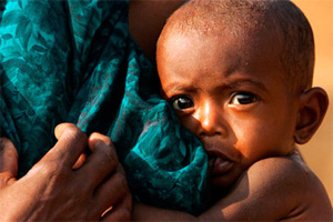 Civil society appeals to policymakers to declare acute malnutrition as national emergency Civil society appeals to policymakers to declare acute malnutrition as national emergency