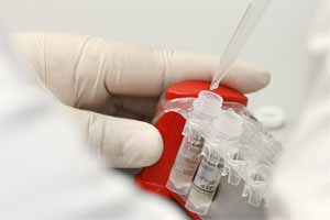 12 new genetic causes of developmental disorders identified