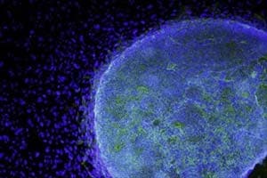Stem cell, Bone, blood, health news
