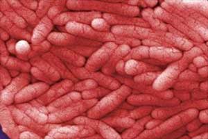 bacteria, antibiotic resistant, antibiotic resistant bacteria, antibiotic resistant superbugs, bacteria superbugs, health news