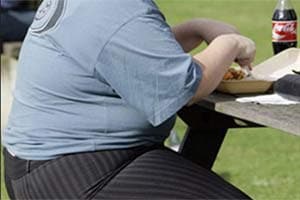obesity