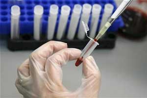 HIV treatment