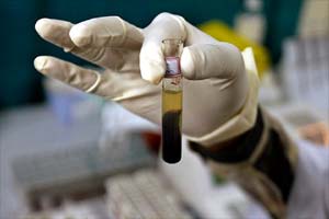 Human feces, human feces composition, human feces facts, human feces fertilizer, gold, silver, scientists, US Geological Survey, fertiliser, landfills, biosolids