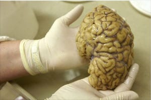 human brain, brain, human being, archaelogy, human brain facts, oldest human brain, science facts, science news