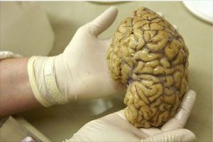 human brain, brain, human being, archaelogy, human brain facts, oldest human brain, science facts, science news