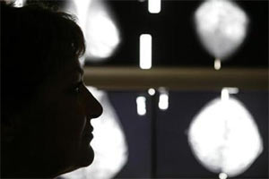 breast cancer, breast cancer to increase by 2030, breast cancer cases, breat cancer in women, breast cancer in men, health news, lifestle, changing lifestyle causes breast cancer, health care