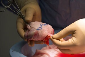 Kidney disease