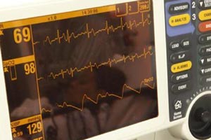 pacemaker