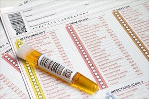 urine test blood cancer