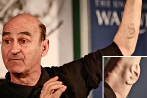 Ear on Arm, australian man Ear on Arm, australian man