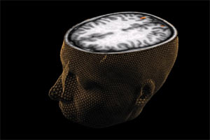 brain
