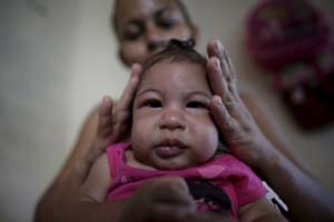 zika virus, zika virus news, zika virus vaccine, zika virus origin, zika virus symptoms, zika virus affected countries, zika virus in india, what is zika virus, zika outbreak, zika disease