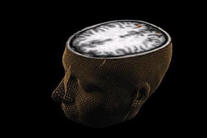 brain