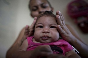 The head of the World Health Organisation (WHO) has asked a panel of experts to consider whether the Rio Summer Olympics should be held as scheduled due to concerns it could spread the Zika virus.(Reuters) The head of the World Health Organisation (WHO) has asked a panel of experts to consider whether the Rio Summer Olympics should be held as scheduled due to concerns it could spread the Zika virus.(Reuters)