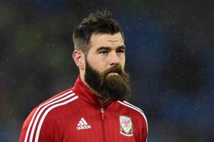 Joe Ledley, Joe Ledley news, Joe Ledley leg break, Joe Ledley leg break latest news, wales team, wales team latest update