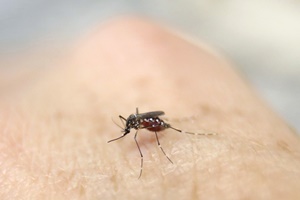 Zika virus Zika virus