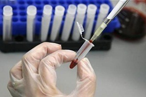 The NAAT is the latest technology to detect minute viruses in the blood. (Reuters)