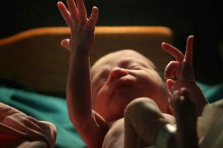 very low birth weight infants, infants prone to osteopenia, osteopenia in babies, osteopenia in premature infants