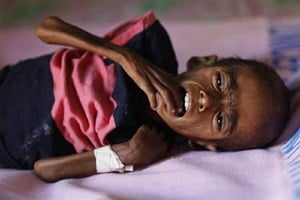 The Commission has taken suo motu cognisance of media reports that 116 children have died due to malnutrition related ailments in Sheopur district. (Reuters)