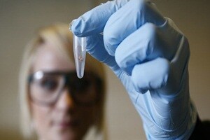 Individuals carrying a gene mutation are at an increased risk of developing neurological disorder related to touch and proprioception -- our "sixth sense" or body awareness -- a study has found. (Reuters)