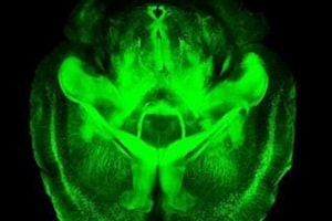 As people age, their peripheral and central auditory system -- areas of the brain that help to intake and interpret sound -- decline in function. (Reuters)