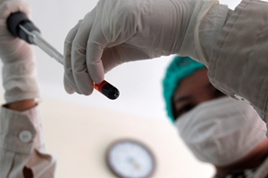 If the IPF, a modern parameter that measures young and thereby reticulated platelets in peripheral blood, is high then there is no requirement of blood transfusion in a dengue patient even if there were initial indications of its requirement, the doctors said. (Reuters) If the IPF, a modern parameter that measures young and thereby reticulated platelets in peripheral blood, is high then there is no requirement of blood transfusion in a dengue patient even if there were initial indications of its requirement, the doctors said. (Reuters)