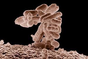 Pyelonephritis -- infection of the kidney usually caused by E. coli bacteria and which can start as a urinary tract infection -- causes fever, back pain and vomiting. (Reuters)