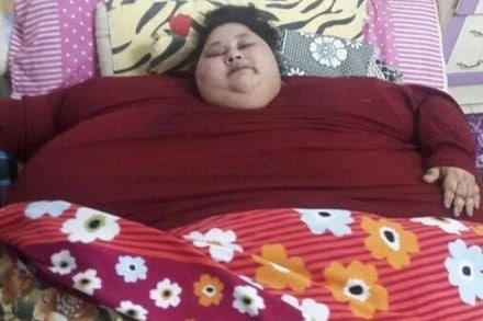 Eman Ahmed, Eman Ahmed weight loss surgery, 500 kg woman, Eman Ahmed sister, Saifee Hospital,