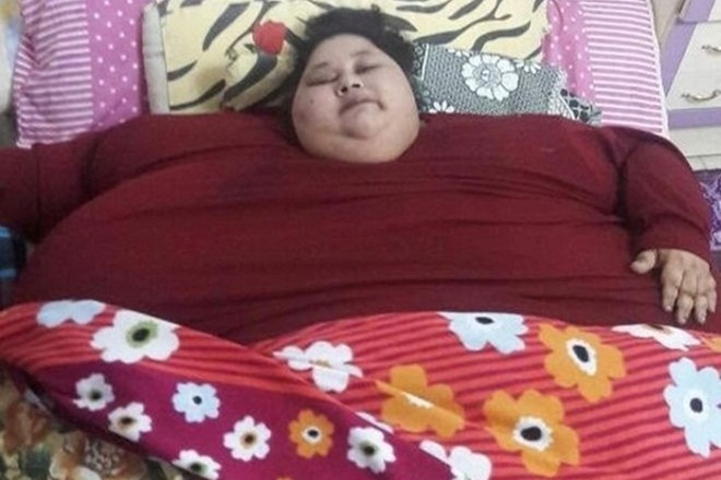 Eman Ahmed, Eman Ahmed weight loss surgery, 500 kg woman, Eman Ahmed sister, Saifee Hospital, Eman Ahmed, Eman Ahmed weight loss surgery, 500 kg woman, Eman Ahmed sister, Saifee Hospital,