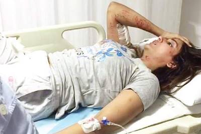 In an attempt to save her pet Parul suffered multiple bites with severe wounds on her face, legs and neck. (New Indian Express)