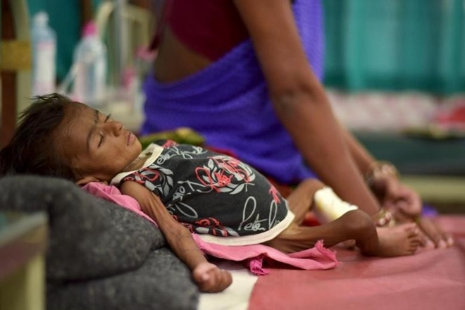 In 2015, one million children (below 14 years) fell prey to TB, whereas 170,000 of them died worldwide. (Reuters) In 2015, one million children (below 14 years) fell prey to TB, whereas 170,000 of them died worldwide. (Reuters)