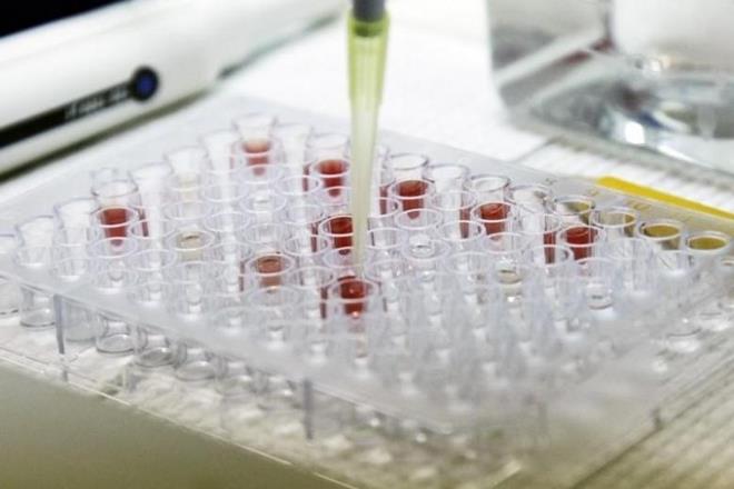 BIRAC supports entrepreneurs and start-ups at different stages of innovation – from the ideation stage to managing intellectual property rights and finally to the commercialisation of products. (Reuters) BIRAC supports entrepreneurs and start-ups at different stages of innovation – from the ideation stage to managing intellectual property rights and finally to the commercialisation of products. (Reuters)