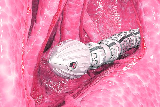 The use of robots inside the human body might sound like the perfect fit for a sci-fi flick and bizarre in real life. But robotics and automation are, believe it or not, playing a pivotal role in the world of medicine these days.