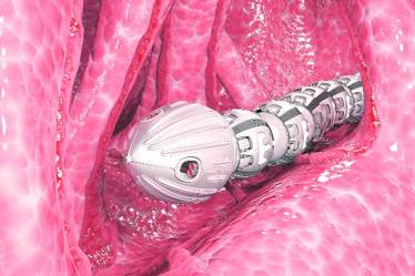 The use of robots inside the human body might sound like the perfect fit for a sci-fi flick and bizarre in real life. But robotics and automation are, believe it or not, playing a pivotal role in the world of medicine these days.