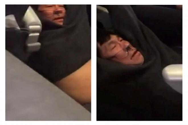 The 69-year-old Vietnamese-American doctor was hospitalized after Chicago aviation police dragged him from the plane to make space for crew members on the flight. (Reuters) The 69-year-old Vietnamese-American doctor was hospitalized after Chicago aviation police dragged him from the plane to make space for crew members on the flight. (Reuters)