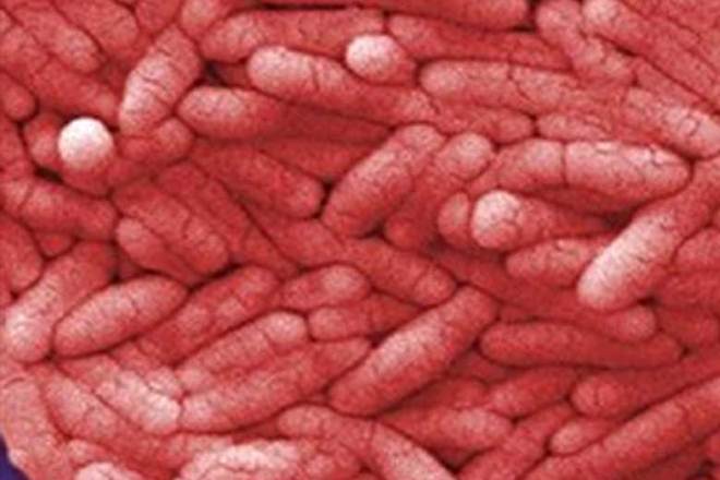 Gut bacteria, slow down ageing, ageing, research on ageing, Alzheimer, gene deletion library ,bacterium E.coli,  progression of tumours