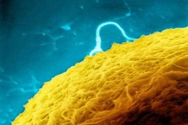 Wallpaper fungus, fungus, home fungus, wall fungus, fungus growing on the wallpapers in our home, mycotoxins, sick building syndrome, Penicillium brevicompactum, Aspergillus versicolor, Stachybotrys chartarum