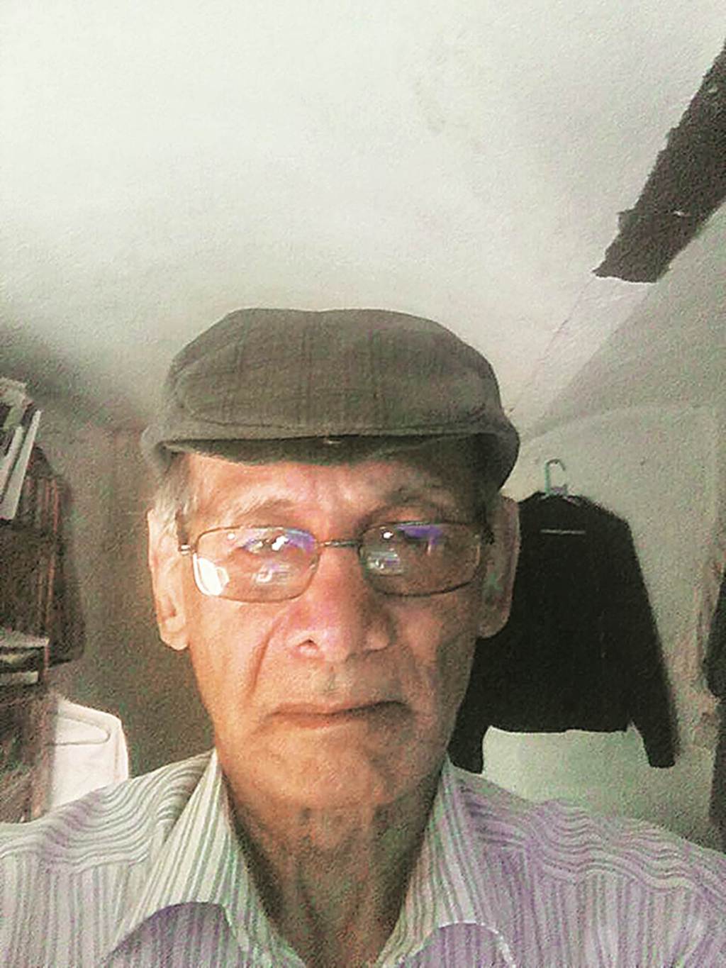The 73-year old collapsed in jail a few days ago and is slated to undergo an open heart surgery in Kathmandu on Saturday. The 73-year old collapsed in jail a few days ago and is slated to undergo an open heart surgery in Kathmandu on Saturday.