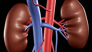 Robotic surgery, Robotic surgery India, Robotic Surgery in India, kidney transplant, robotic surgery kidney transplant, Saifee Hospital, robotic surgery of cancer patient, kidney transplant in India, Cancer treatment in India, Financial Express