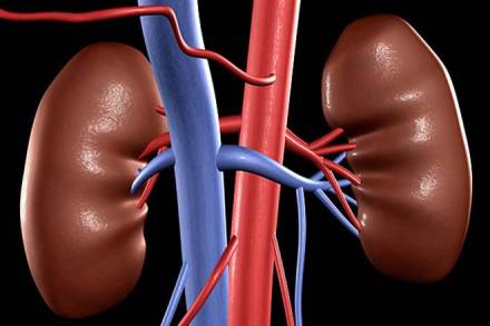 Reliance Foundation Hospital and Research Centre, Robotic kidney, Transplant surgery, renal failure