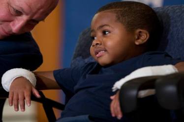 hand transplant, US, world first double hand transplant, Division of Plastic Surgery at Penn Medicine, Hand Transplant Programme, kidney transplant