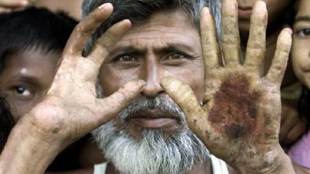 Pakistan, Arsenic, Arsenic Study, US Study, WHO, Toxic Acid