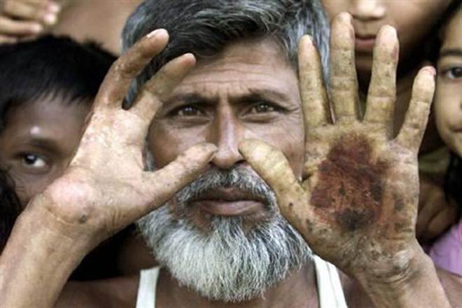 Pakistan, Arsenic, Arsenic Study, US Study, WHO, Toxic Acid