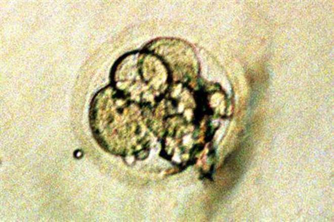 US scientists , US scientists news, human embryos,human embryos news, baby
