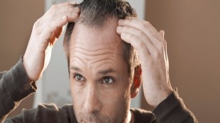 Hair Fall, Hair losing, hair shampoos, hair care, soultree, coconut oil, black hair, hair problems