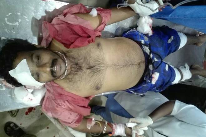 RSS worker in kerala, RSS kerala, kerala RSS, RSS worker hacked, RSS worker injured, Kannur district of Kerala,  Police